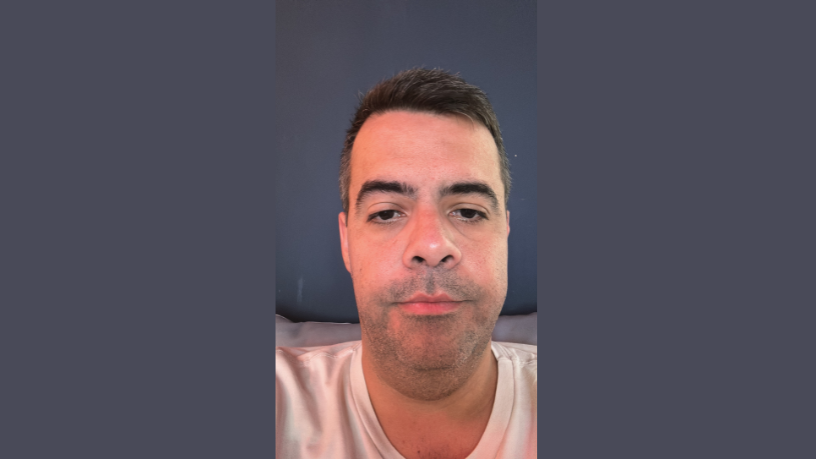 A partir da análise de Vinicius Tadeu Sattin Rodrigues, o texto discute a relação entre compressão mamária e desconforto, trazendo reflexões importantes para a prática clínica.