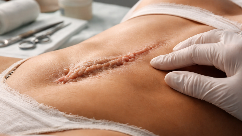 Haeckel Cabral Moraes